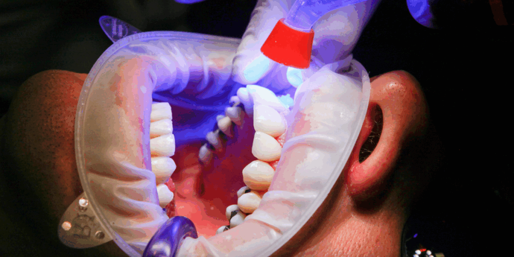 duracion empaste dental